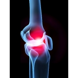 fisioterapia de joelho ligamento cruzado Pacaembu