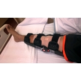 fisioterapia joelho operado Santa Cecília